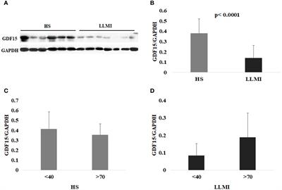 Different roles of circulating and intramuscular GDF15 as markers of skeletal muscle health